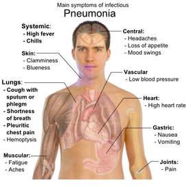 gejala pneumonia